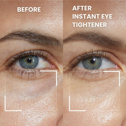 Instant Eye Tightener Easy-Wear Technology