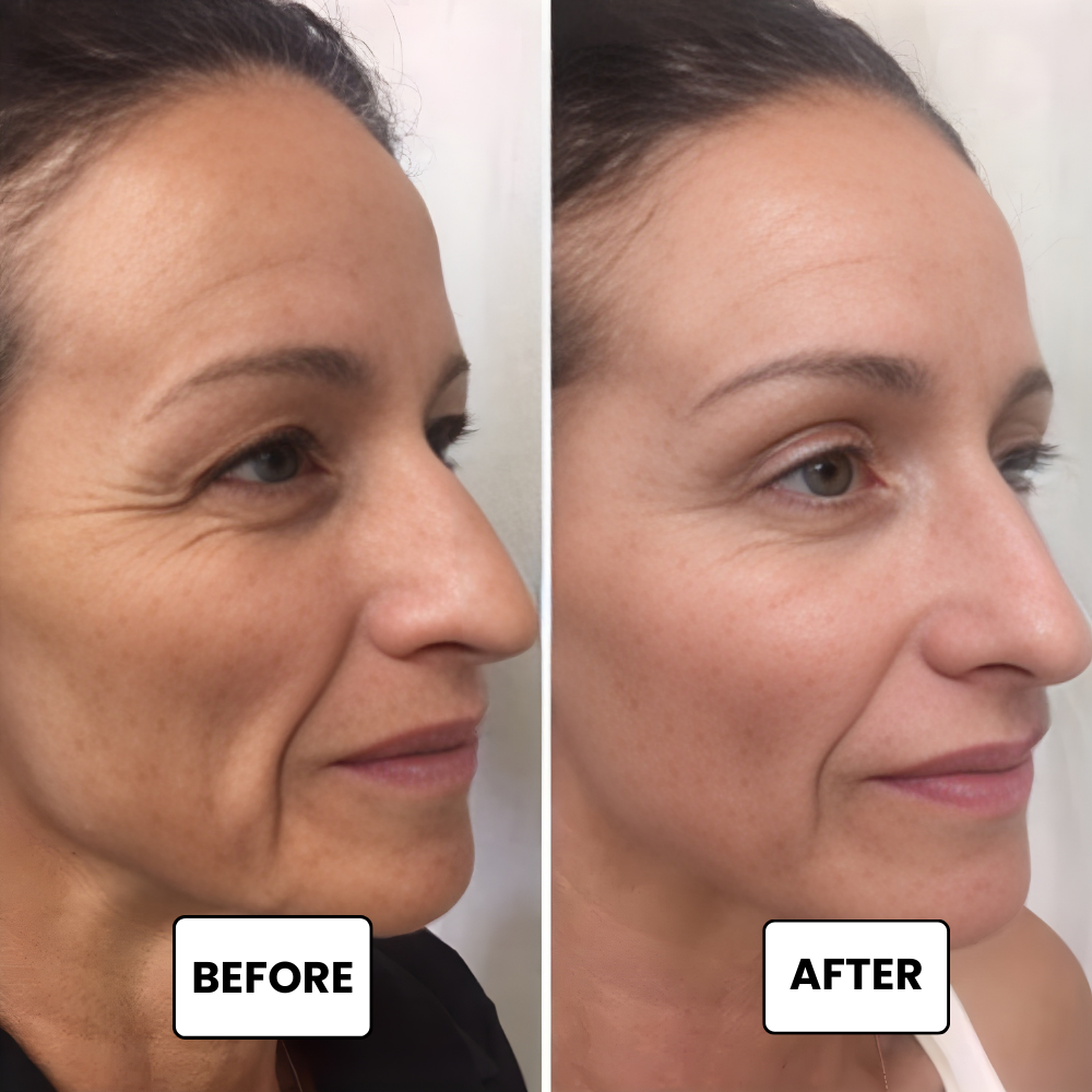 Instant Eye Tightener Easy-Wear Technology