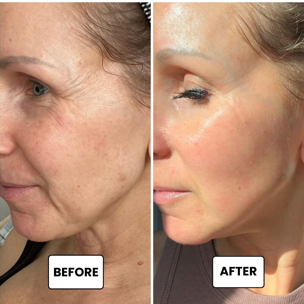 Instant Eye Tightener Easy-Wear Technology
